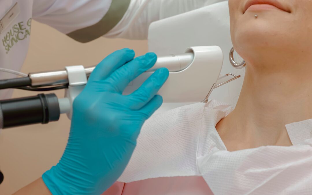 How IPL Can Treat Sun Damage, Wrinkles, and Redness?